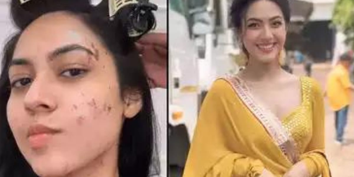 टीवी इंडस्ट्री में पसरा मातम, इन 3 फेमस एक्टर्स के साथ हुआ बड़ा हादसा, गंभीर हालत में अस्पताल में हुए भर्ती 3 टीवी इंडस्ट्री में पसरा मातम, इन 3 फेमस एक्टर्स के साथ हुआ बड़ा हादसा, गंभीर हालत में अस्पताल में हुए भर्ती