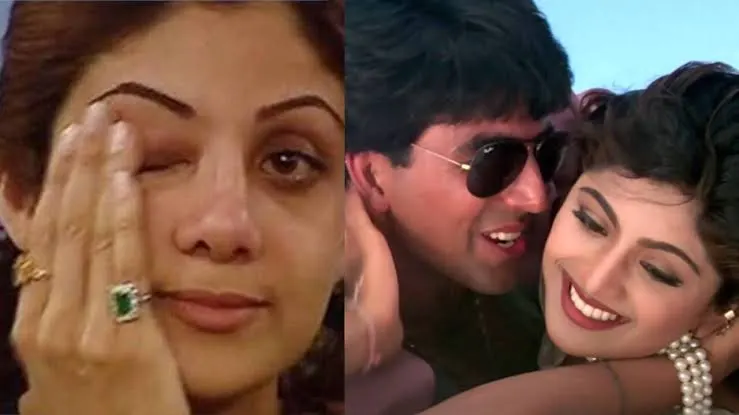 शिल्पा शेट्टी ने अक्षय कुमार से मिले धोखे पर तोड़ी चुप्पी, बोलीं - 'मेरा यूज कर छोड़ दिया...' 4 Shilpa Shetty