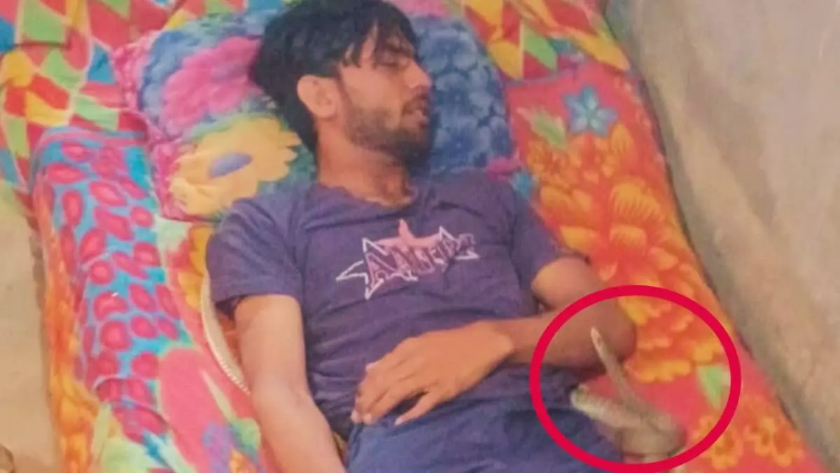कोबरा सांप ने युवक से लिया पुराने जन्म का बदला, 10 बार काटा, फिर रात भर लाश के पास मनाया जश्न 5 Snake Bite